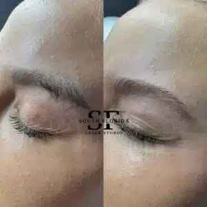 Side-by-side eyebrow pigment comparison with South Florida Laser Studio branding.